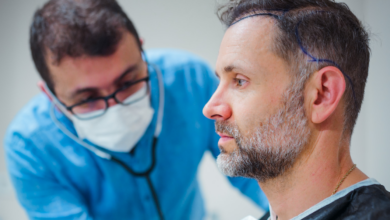 Best Hair Transplant