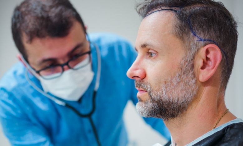 Best Hair Transplant